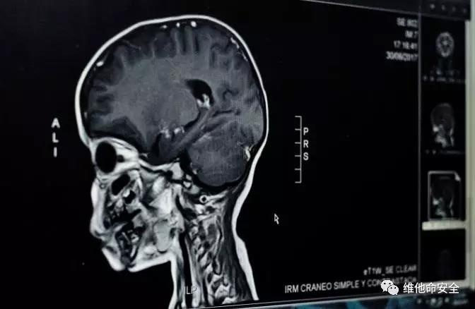 �Ϲ�NG����(�й�)�ٷ���վ